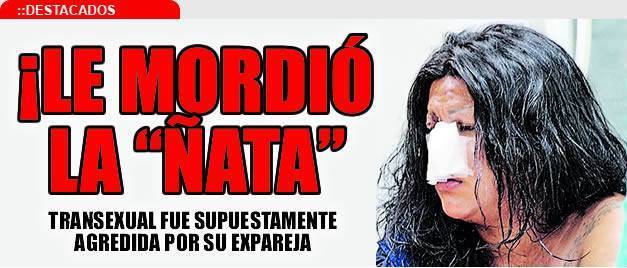 la ex pareja de una transexual le arrancó la nariz de un mordisco 2