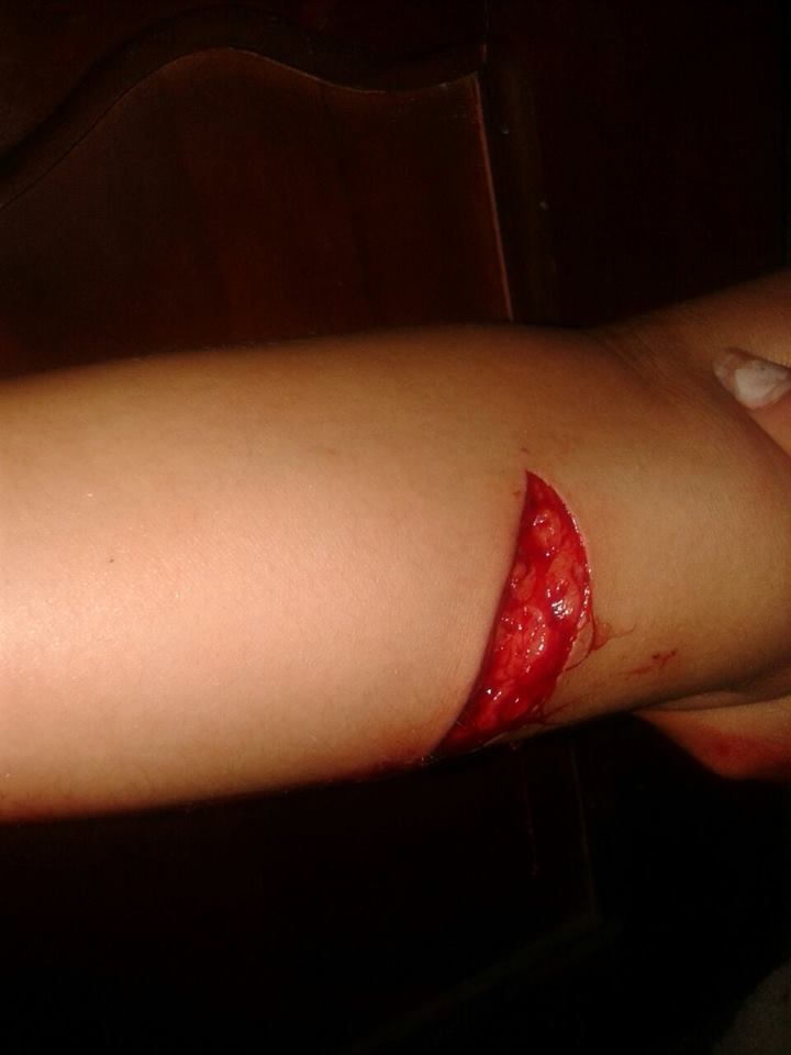 Intentan a asesinar a androgina en Durán - Ecuador -SiluetaX (2)