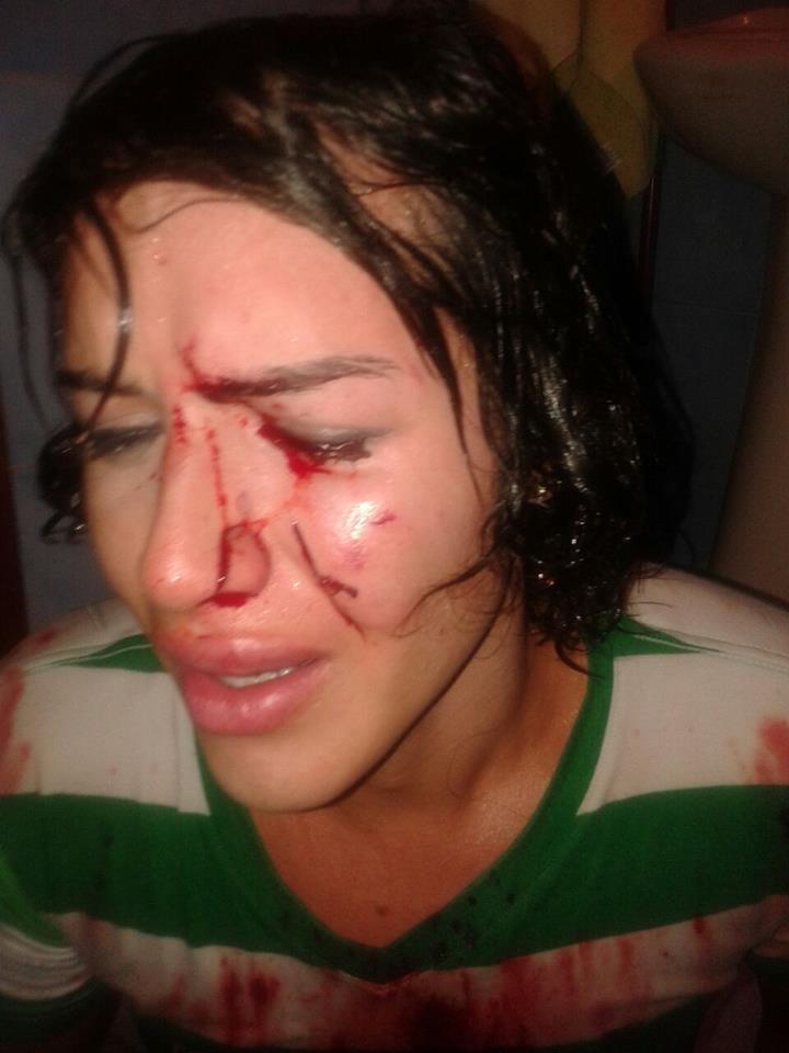 Intentan a asesinar a androgina en Durán - Ecuador -SiluetaX (5)