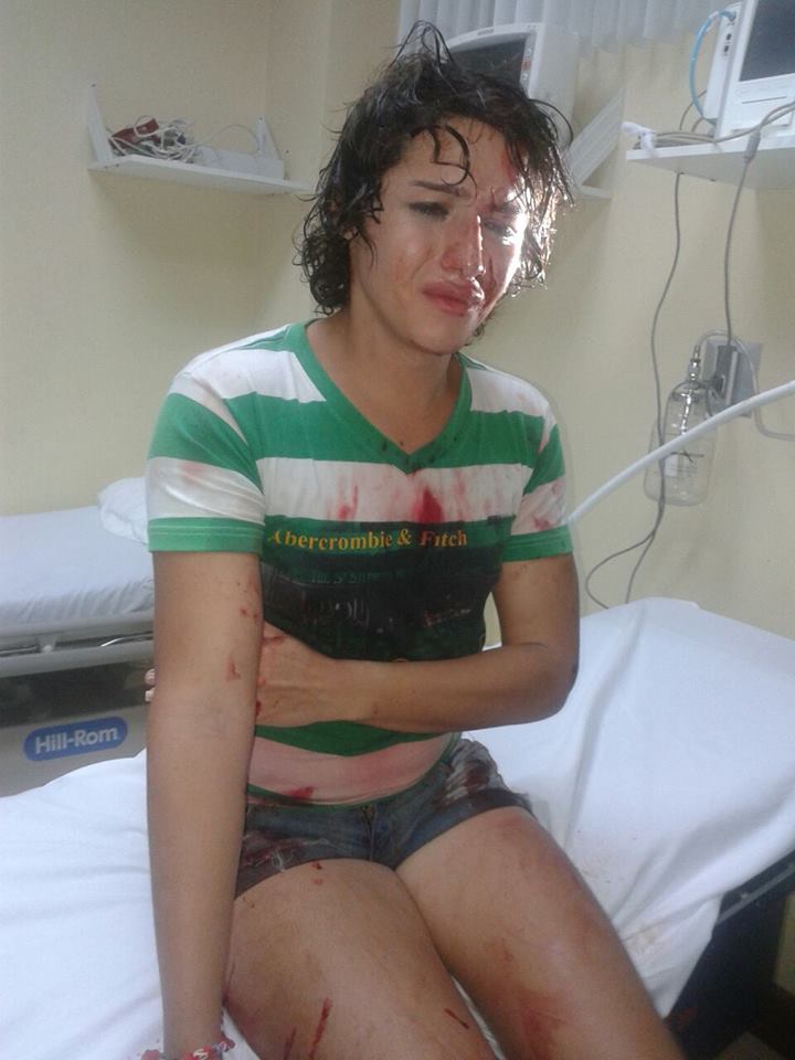 Intentan a asesinar a androgina en Durán - Ecuador -SiluetaX (6)