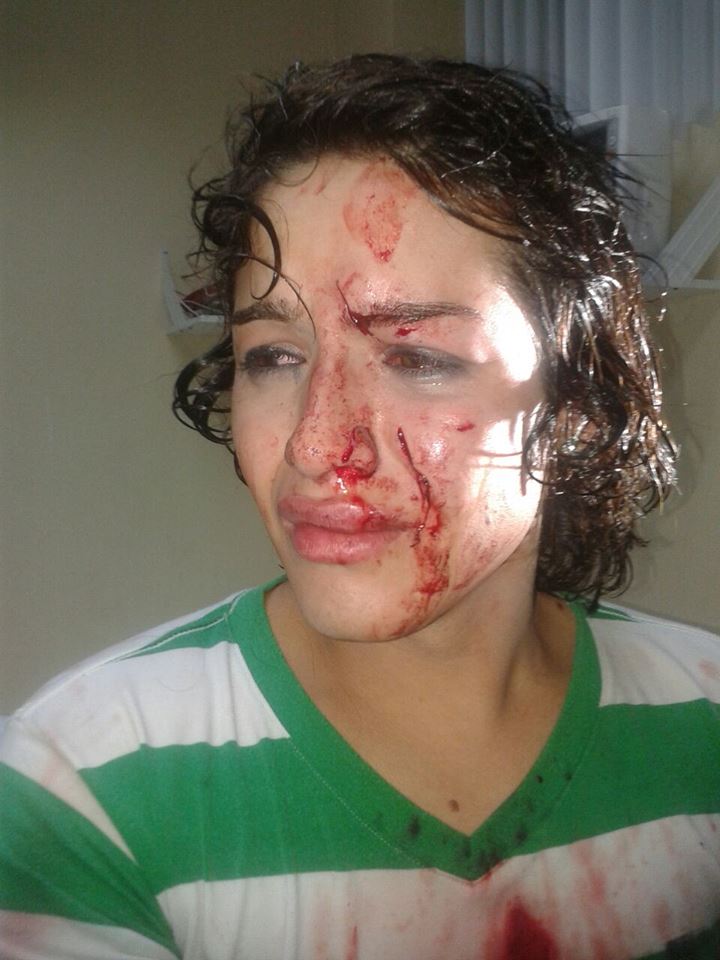 Intentan a asesinar a androgina en Durán - Ecuador -SiluetaX (7)